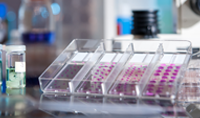 lncRNA编码蛋白SMIM30激活MAPK通路促进肝癌发生