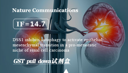 Chen X.Y. et al: DSS1 inhibits autophagy to activate epithelial-mesenchymal transition in a pro-metastatic niche of renal cell carcinoma